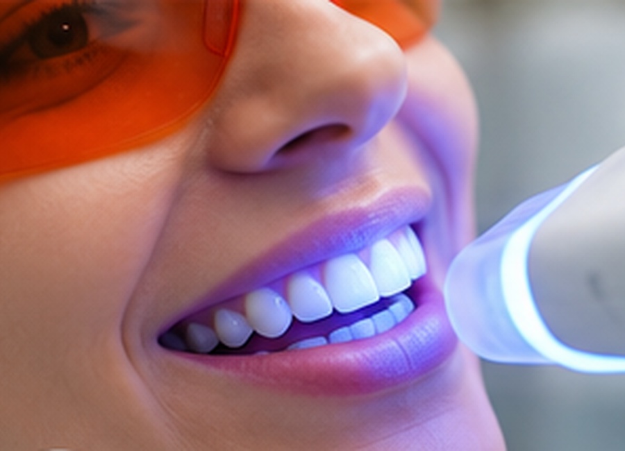 Professional teeth whitening